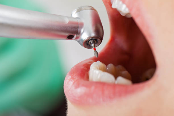 Best Emergency Dental Care for Trauma or Injury in Taylor, TX